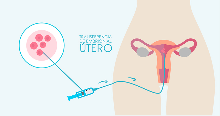 los expertos en reproduccion asistida de instituto de fertilidad mallorca te explican el paso a a paso del tratamiento de fertilidad fecudacion in vitro