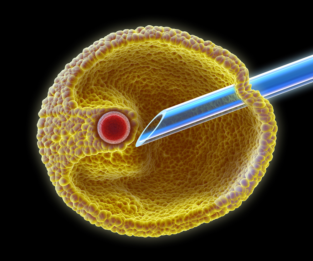 Puncion ovarica resuelve todas tus dudas sobre esta prueba que se realiza en los tratamientos de fertilidad en el blog de IFER Mallorca